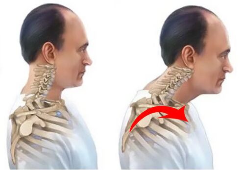 Himsog ug sakit nga spine