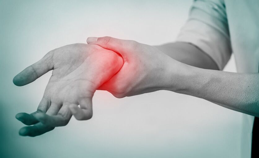 Sakit tungod sa arthrosis sa pulso nga hiniusa